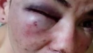 violencia por seguridad privada del salon vial
